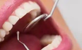 Alternatives to Tooth Extraction