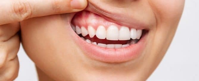 Long-Term Effects of Untreated Gum Disease
