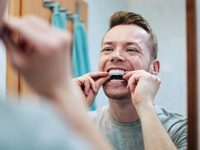How Teeth Whitening Works
